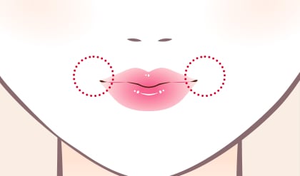 口角挙上 イメージ