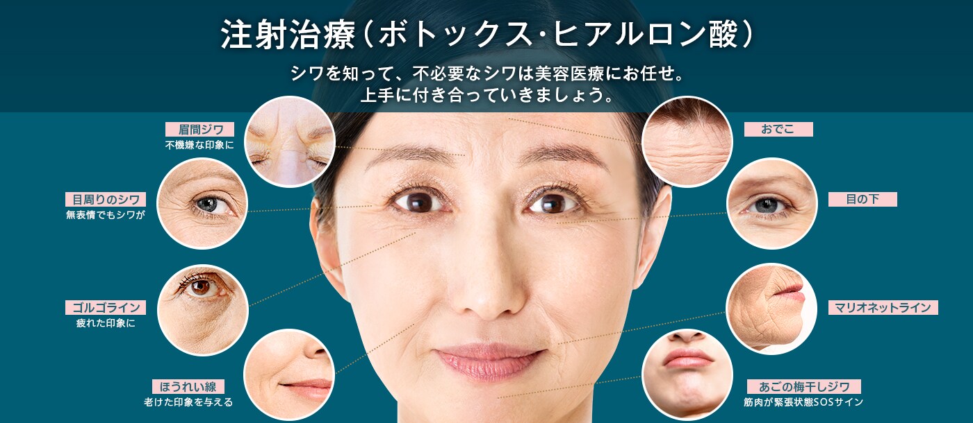 注射治療(ボトックス・ヒアルロン酸)