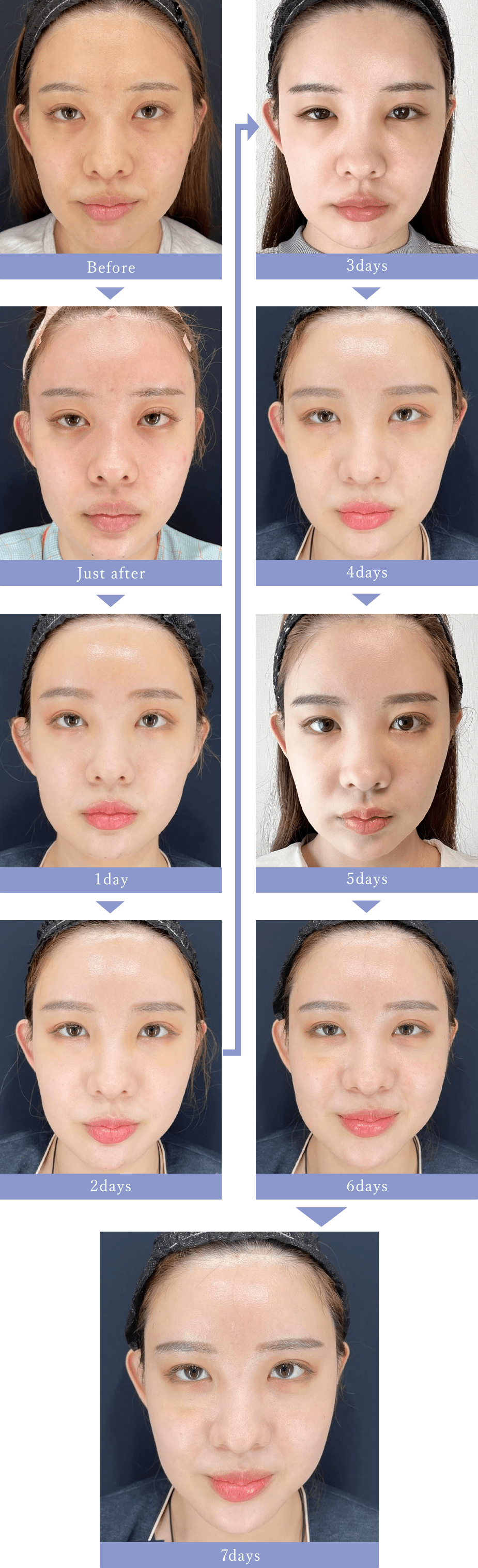 Before After