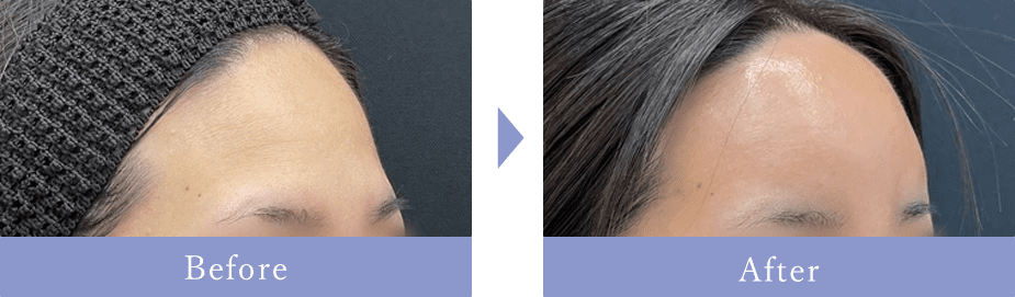 Before After