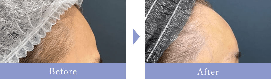 Before After