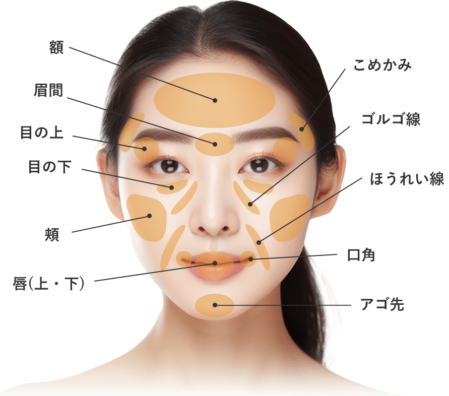 ナチュラル脂肪注射コンデンスリッチ(お顔の脂肪注入)の対象部位