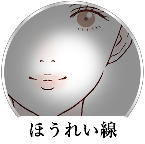 ほうれい線