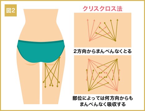 図2：クリスクロス法