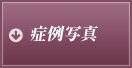 症例写真