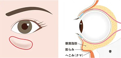 手術の流れ イメージ1