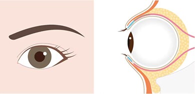 手術の流れ イメージ4