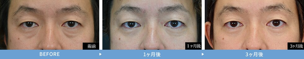 症例写真 イメージ1