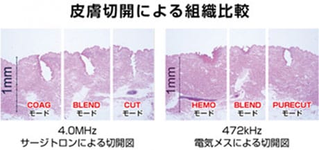 皮膚切開による組織比較