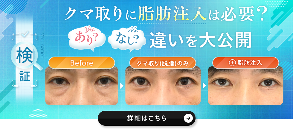 クマ取り＋脂肪注入をしなかった場合