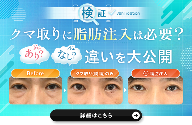 クマ取り＋脂肪注入をしなかった場合