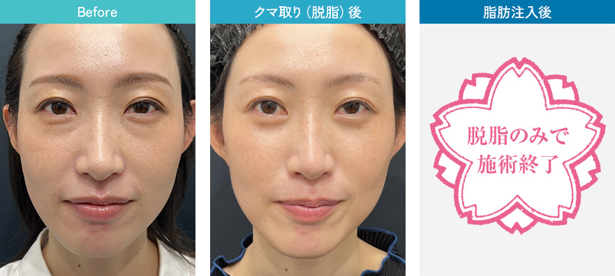 症例写真1
