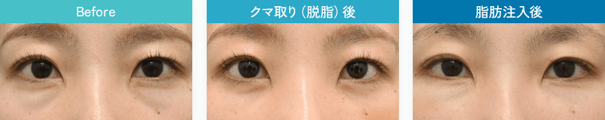 症例写真3