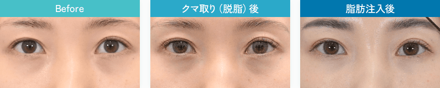症例写真4