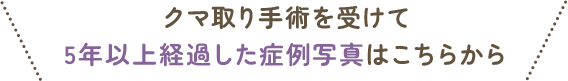 クマ取り手術を受けて5年以上経過した症例写真はこちらから