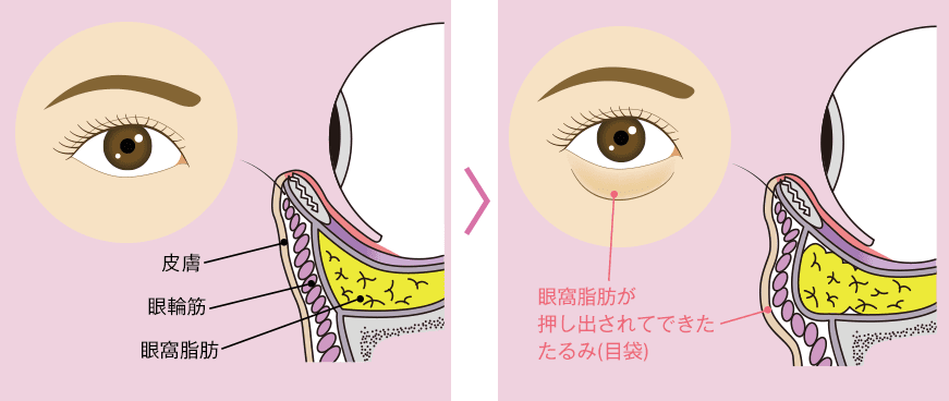 加齢による変化のイメージ