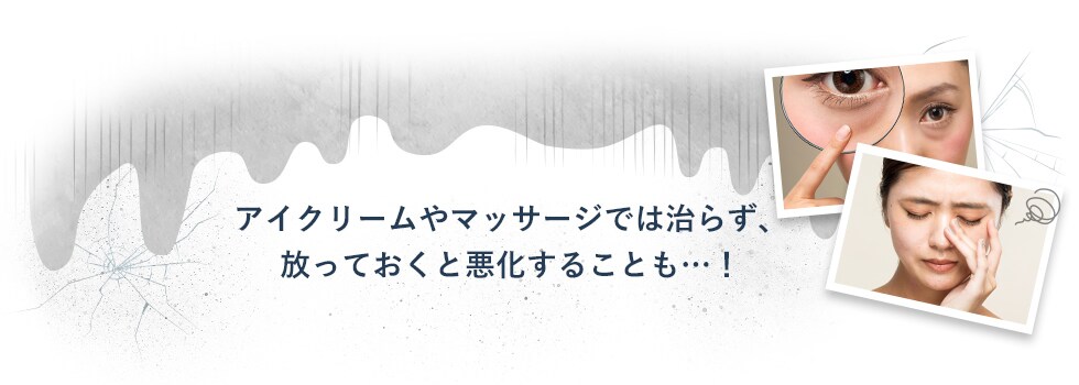 アイクリームやマッサージでは治らず、放っておくと悪化することも…！