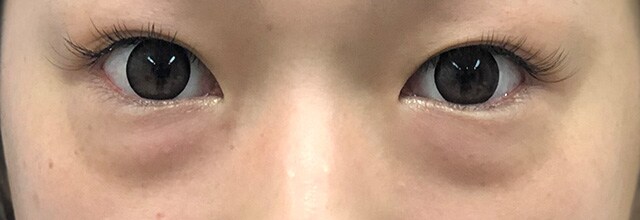 症例写真 術前