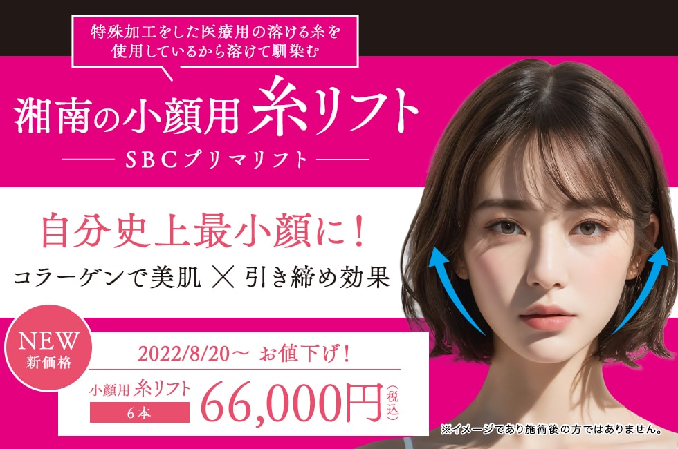 SBCプリマリフト