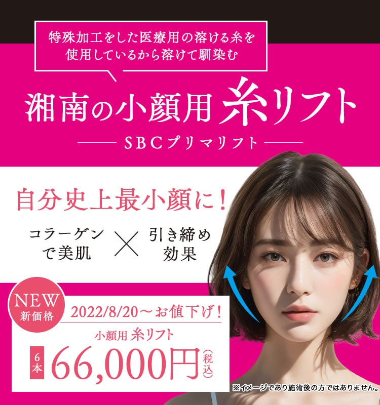 SBCプリマリフト