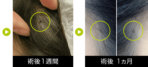 1週間後・1か月後