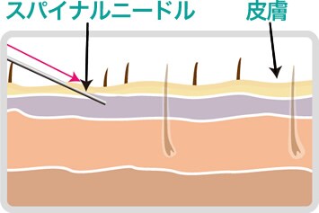step1