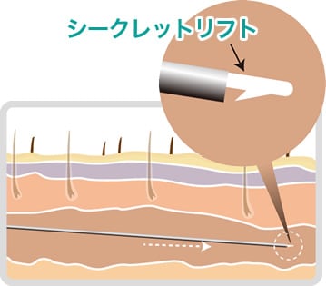 step2