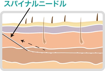 step3