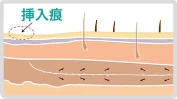 step6