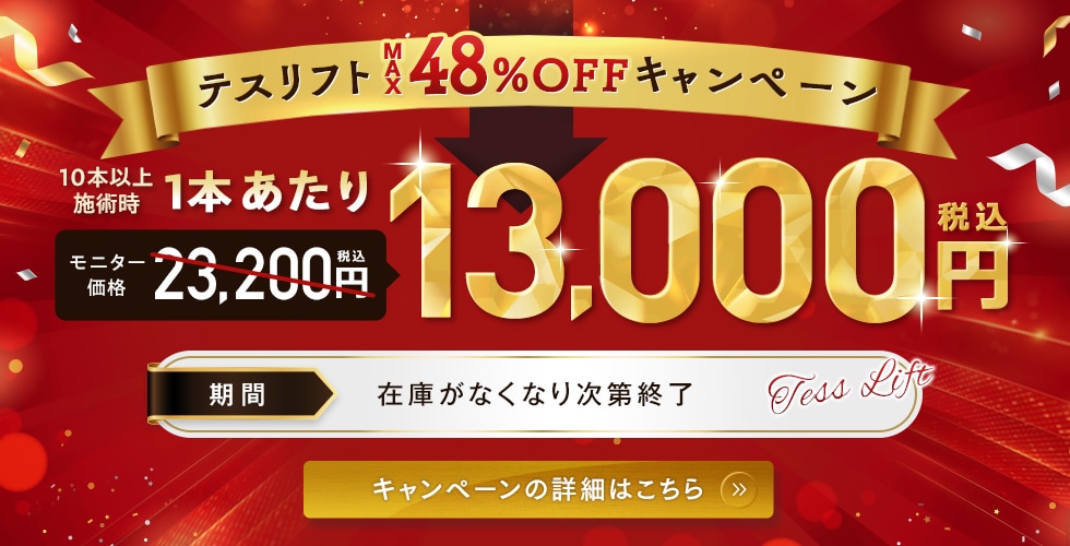 25%OFF