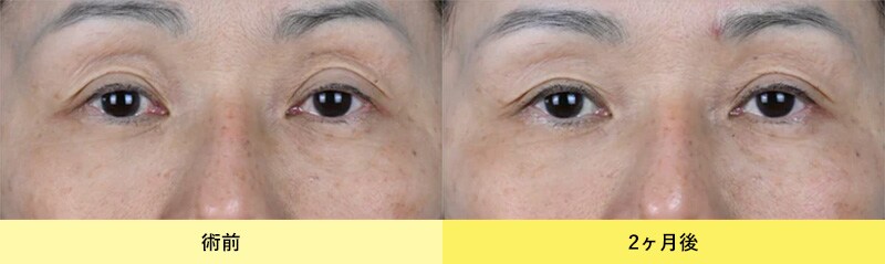 DENSITY（デンシティ）症例写真