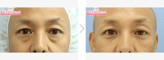 湘南美容のメンズエイジングケア 若返り エイジングケアなら湘南美容クリニック 公式