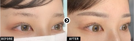 医療アートメイクなら湘南美容クリニック 公式 美容整形 美容外科 医療アートメイクなら湘南美容クリニック 公式 美容整形 美容外科