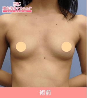 症例写真 術前