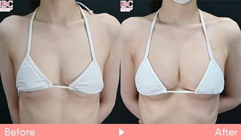 症例写真