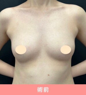 症例写真 術前