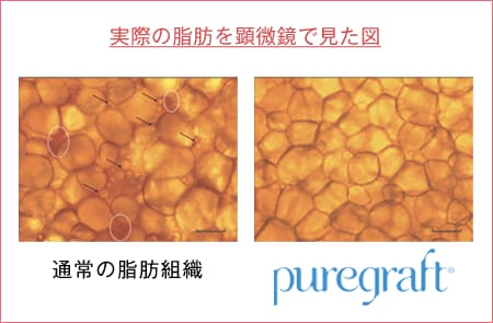 過剰成分97％を除去