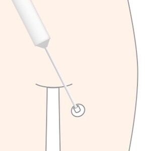 脂肪を採取 イメージ