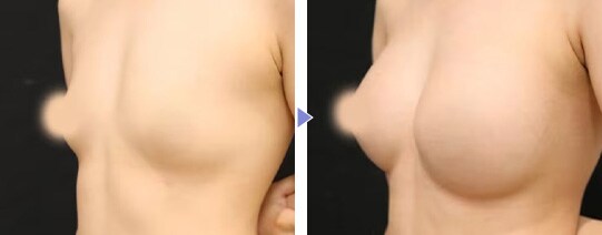 Motivaエルゴノミックス2 症例写真