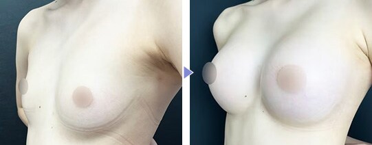 Motivaエルゴノミックス2 症例写真