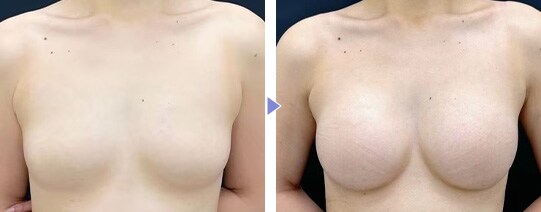 Motivaエルゴノミックス2 症例写真