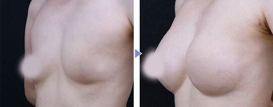 Motivaエルゴノミックス2 症例写真