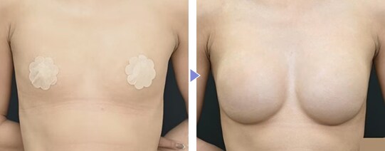 Motivaエルゴノミックス2 症例写真