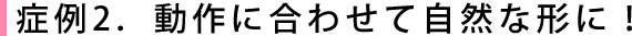 症例2．動作に合わせて自然な形に！