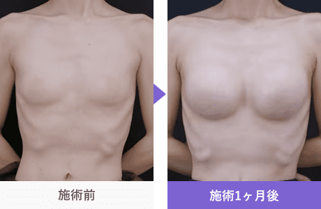Motivaエルゴノミックス2 症例写真 310528