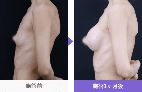 Motivaエルゴノミックス2 症例写真 310615