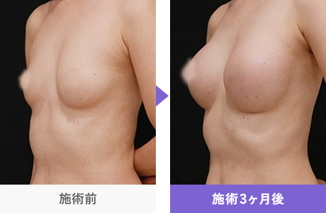 Motivaエルゴノミックス2 症例写真 330551