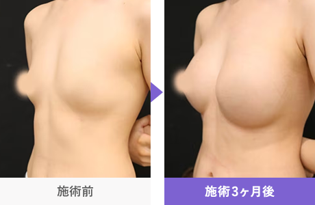 Motivaエルゴノミックス2 症例写真 353290