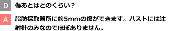 Q 傷あとはどのくらい？ A 脂肪採取箇所に約5ｍｍの傷ができます。バストには注射針のみなのでほぼありません。