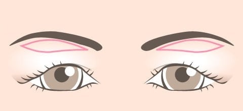 皮膚切除をデザイン